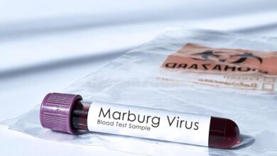 عودة فيروس "ماربورغ" الفتاك.. الصحة العالمية تُعلن تفشيه بغانا - ALMASSAA ALYOUM المساء اليوم