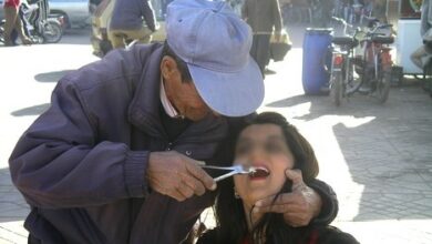 صانعو ومركبو الأسنان بالمغرب يدعون لمحاربة الفوضى بالقطاع - ALMASSAA ALYOUM المساء اليوم