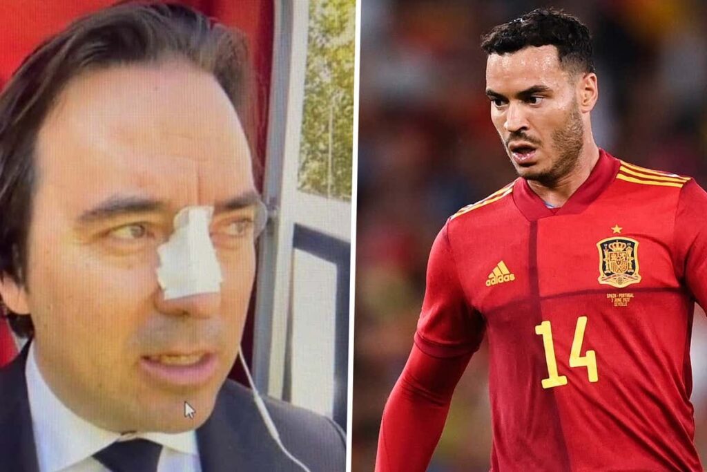 جنون الانتقالات بإسبانيا: ضربة رأسية بسبب لاعب..!